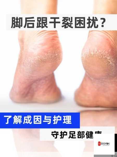 足部健康与舒适：全面护理指南